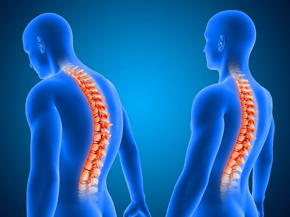 Spine Surgery